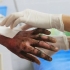 Persona quemada por manipular polvora